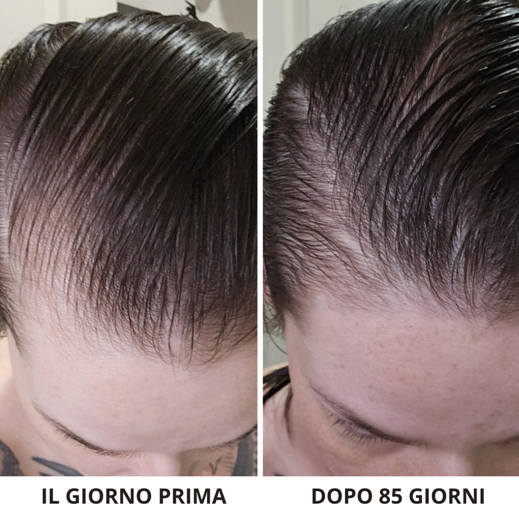 HairRevive Pro