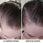 HairRevive Pro